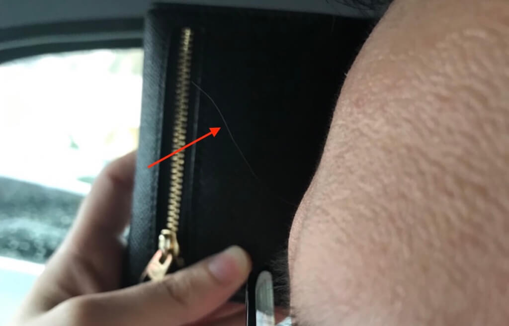 額から宝毛(福毛)